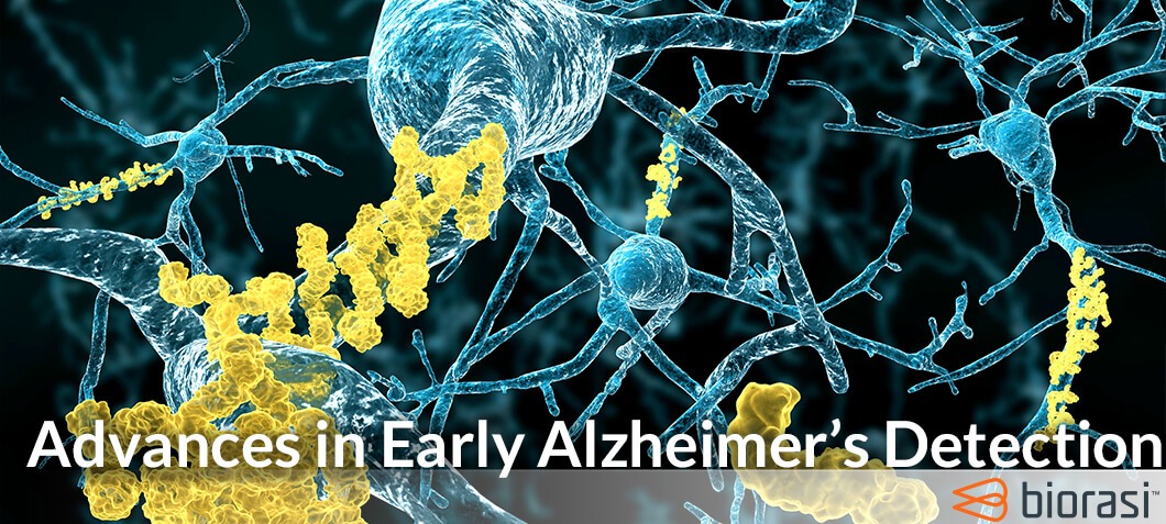 Advances in Early Alzheimer's Detection